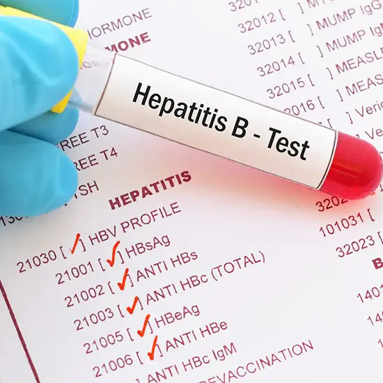 hepatitis b surface antigen confirmation (hbsag)